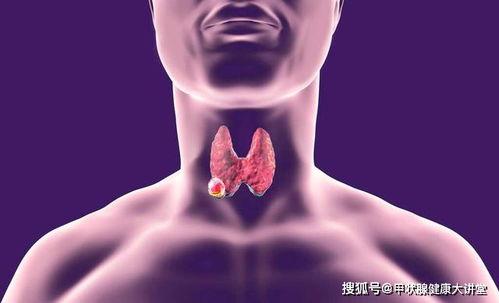 甲状腺手术的明星,揭秘术后康复与生活新篇章